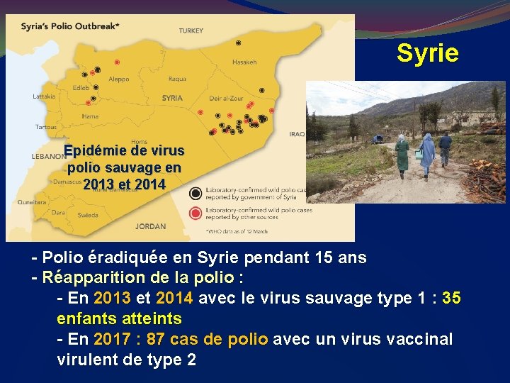 Syrie Epidémie de virus polio sauvage en 2013 et 2014 - Polio éradiquée en