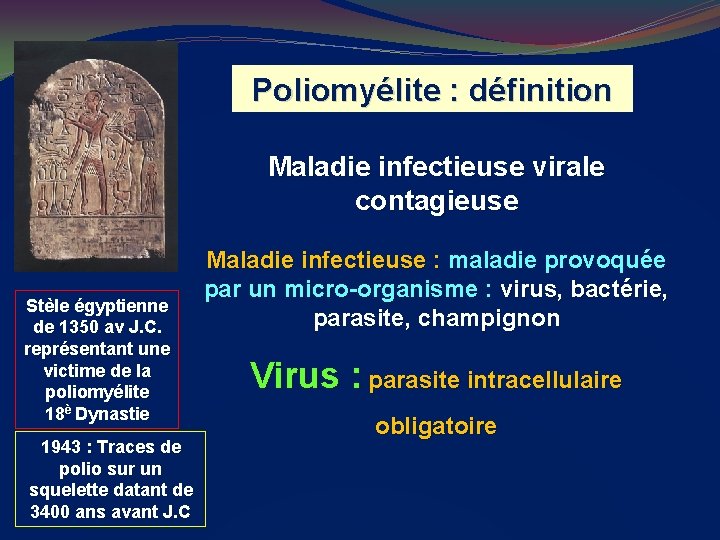 Poliomyélite : définition Maladie infectieuse virale contagieuse Stèle égyptienne de 1350 av J. C.