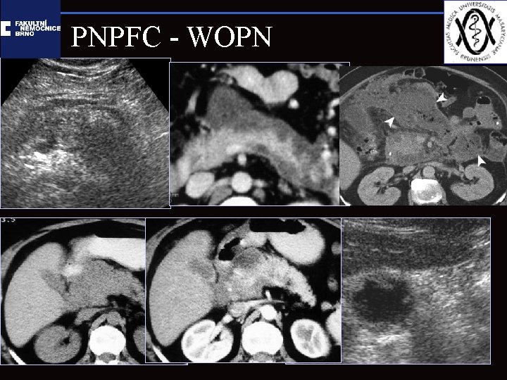 PNPFC - WOPN 