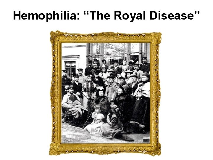 Hemophilia: “The Royal Disease” 