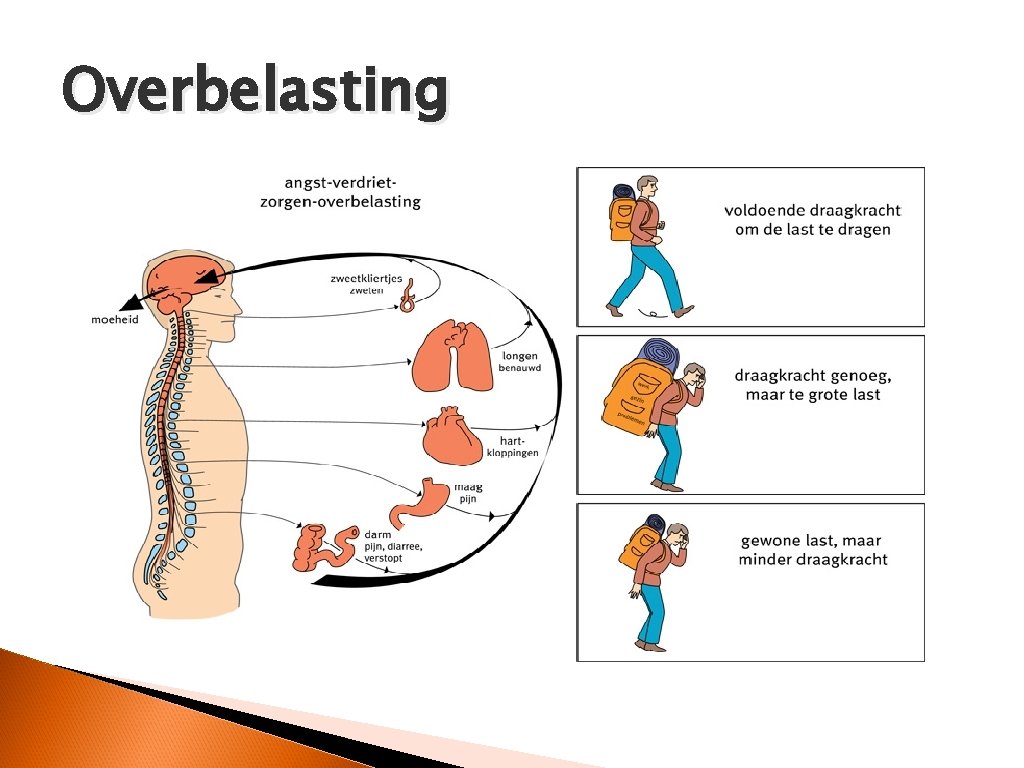 Overbelasting 