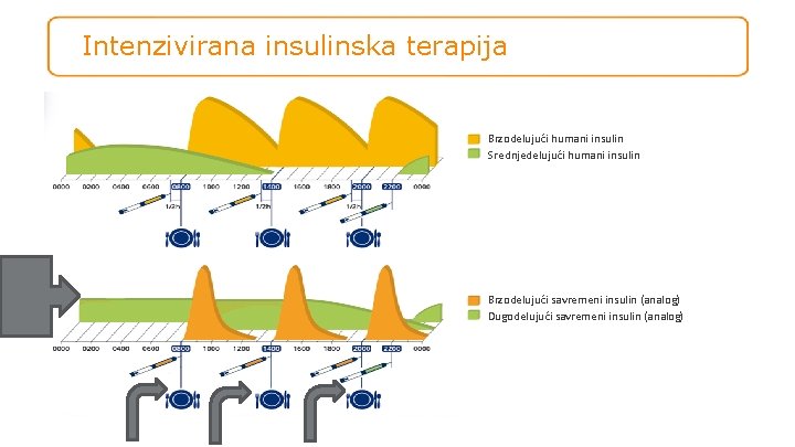 Intenzivirana insulinska terapija Brzodelujući humani insulin Srednjedelujući humani insulin Brzodelujući savremeni insulin (analog) Dugodelujući