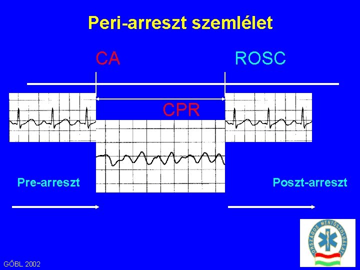 Peri-arreszt szemlélet CA ROSC CPR Pre-arreszt GŐBL 2002 Poszt-arreszt 