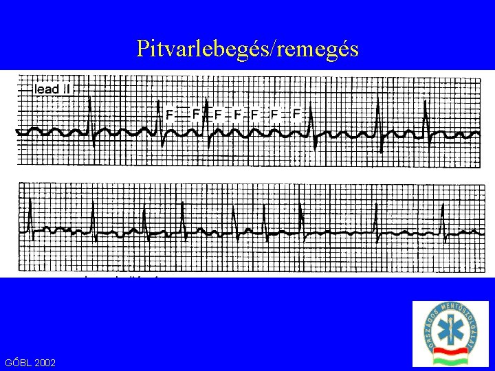 Pitvarlebegés/remegés GŐBL 2002 