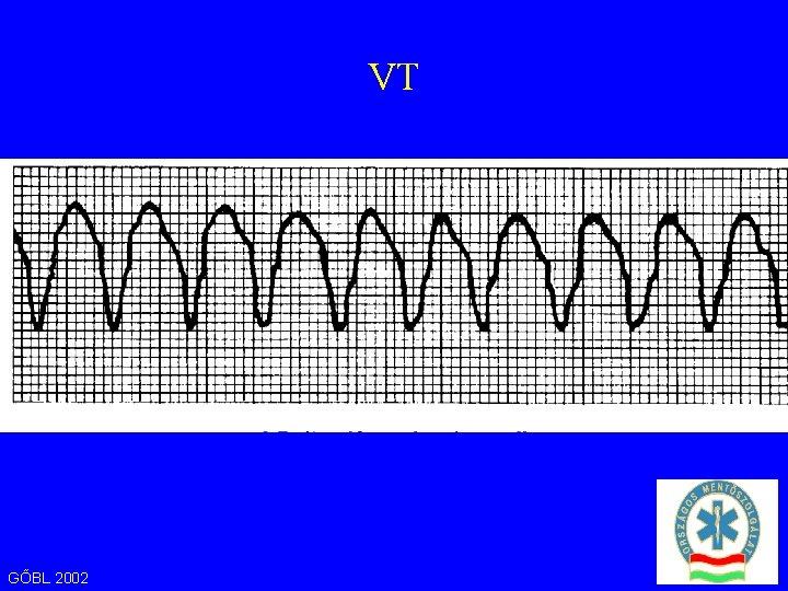 VT GŐBL 2002 