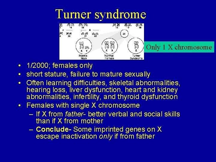 Turner syndrome Only 1 X chromosome • 1/2000; females only • short stature, failure