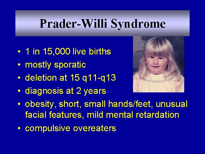 Prader-Willi Syndrome • • • 1 in 15, 000 live births mostly sporatic deletion