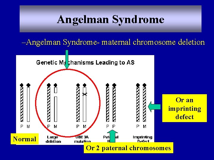 Angelman Syndrome –Angelman Syndrome- maternal chromosome deletion Or an imprinting defect Normal Or 2