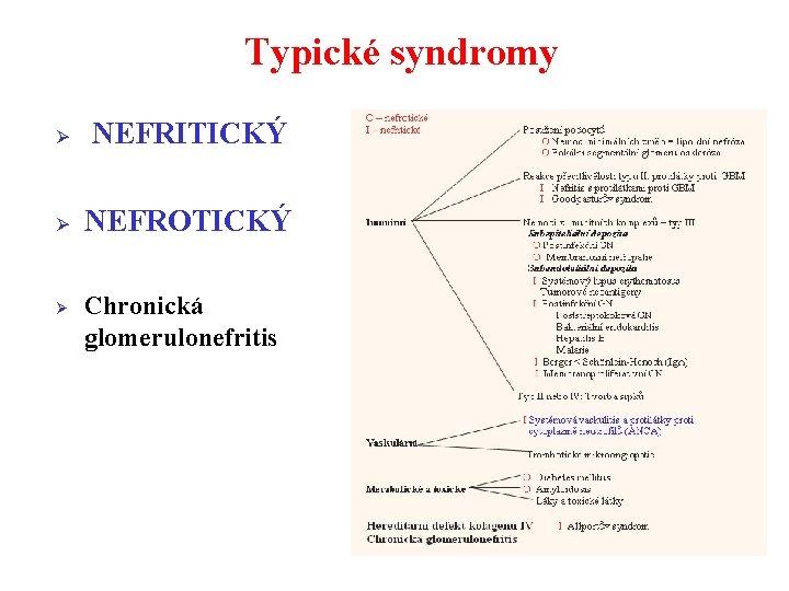 Typické syndromy Ø NEFRITICKÝ Ø NEFROTICKÝ Ø Chronická glomerulonefritis 