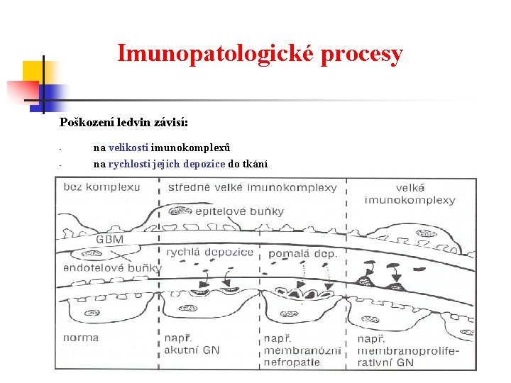 Imunopatologické procesy Poškození ledvin závisí: - na velikosti imunokomplexů na rychlosti jejich depozice do