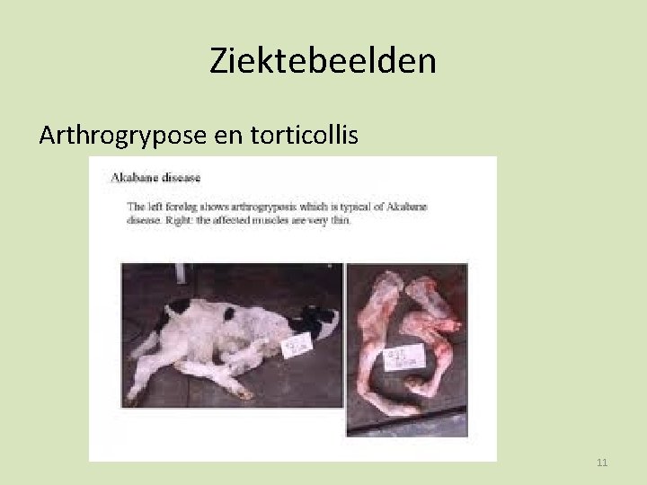 Ziektebeelden Arthrogrypose en torticollis 11 