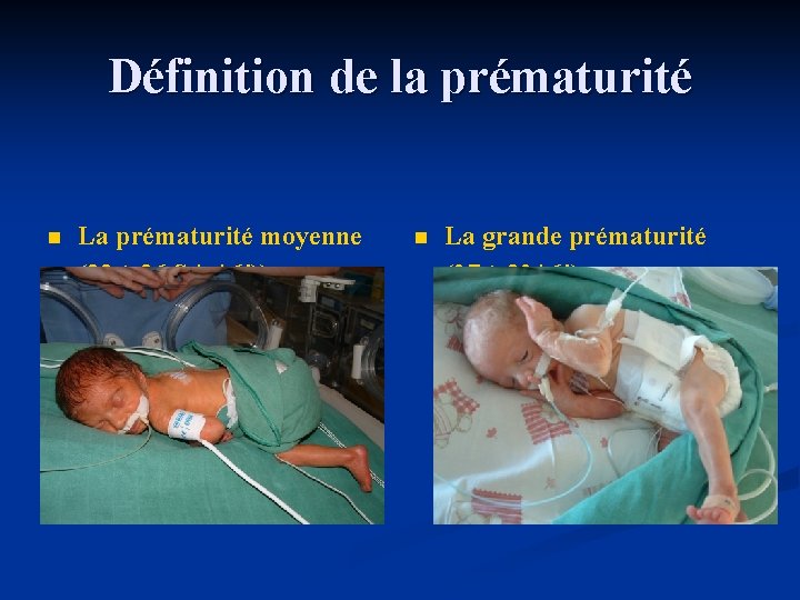 Définition de la prématurité n La prématurité moyenne (33 à 36 SA +6 j))