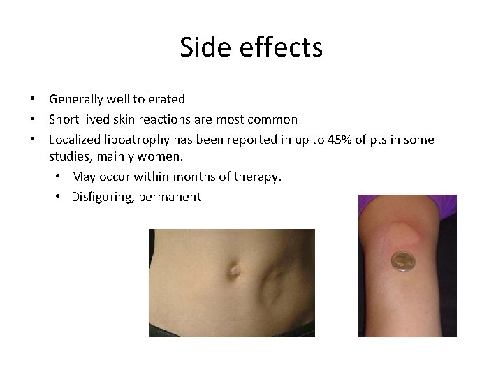 Side effects • Generally well tolerated • Short lived skin reactions are most common
