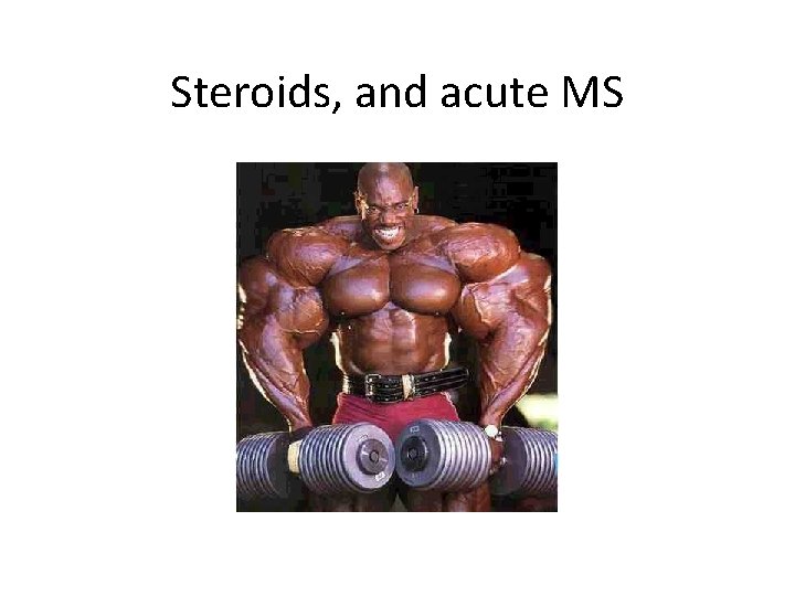 Steroids, and acute MS 