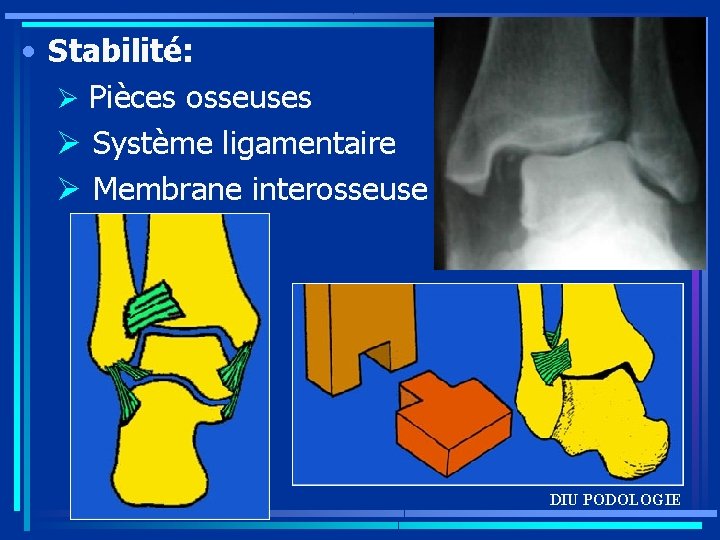  • Stabilité: Ø Pièces osseuses Ø Système ligamentaire Ø Membrane interosseuse DIU PODOLOGIE