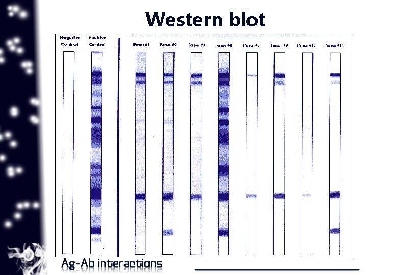 Western blot 