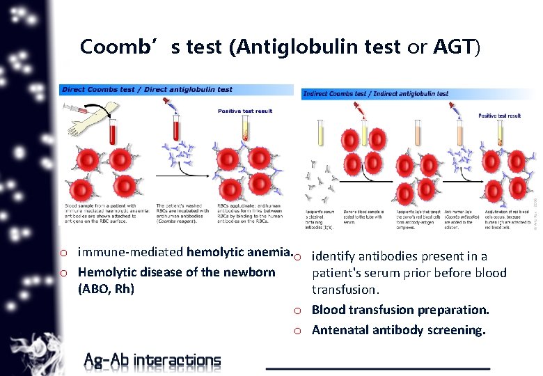 Coomb’s test (Antiglobulin test or AGT) o immune-mediated hemolytic anemia. o o Hemolytic disease
