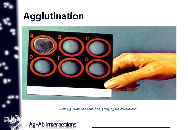 Agglutination Latex agglutination: Lancefield grouping for streptococci 