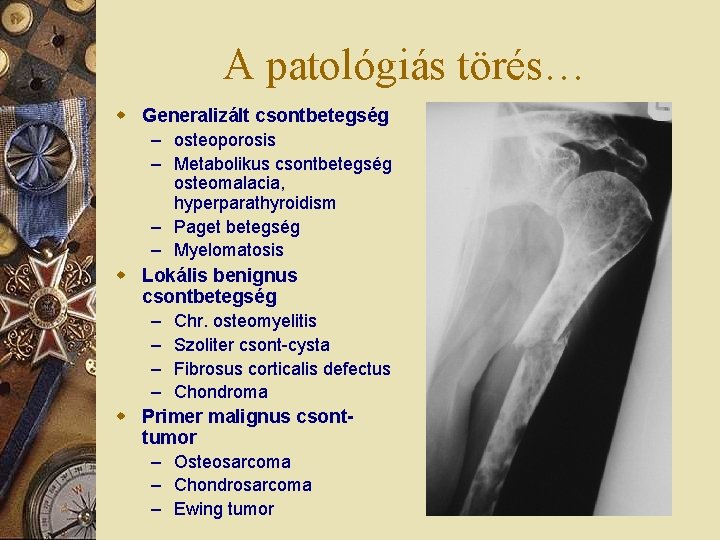 A patológiás törés… w Generalizált csontbetegség – osteoporosis – Metabolikus csontbetegség osteomalacia, hyperparathyroidism –