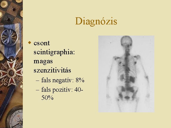 Diagnózis w csont scintigraphia: magas szenzitivitás – fals negatív: 8% – fals pozitív: 4050%