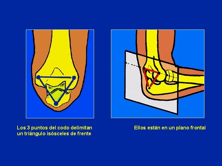 Los 3 puntos del codo delimitan un triángulo isósceles de frente Ellos están en