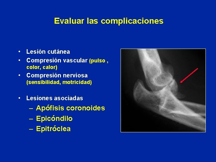 Evaluar las complicaciones • Lesión cutánea • Compresión vascular (pulso , color, calor) •