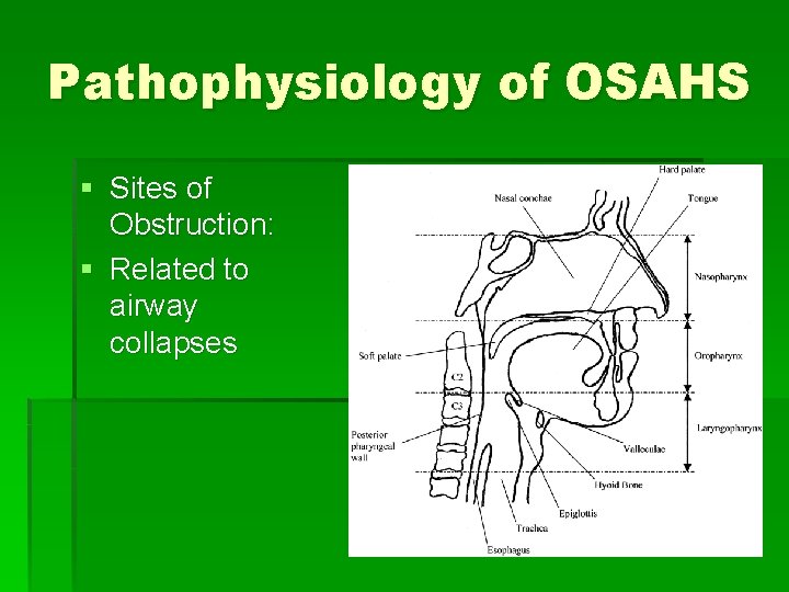 Pathophysiology of OSAHS § Sites of Obstruction: § Related to airway collapses 