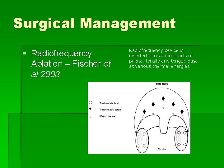 Surgical Management § Radiofrequency Ablation – Fischer et al 2003 Radiofrequency device is inserted