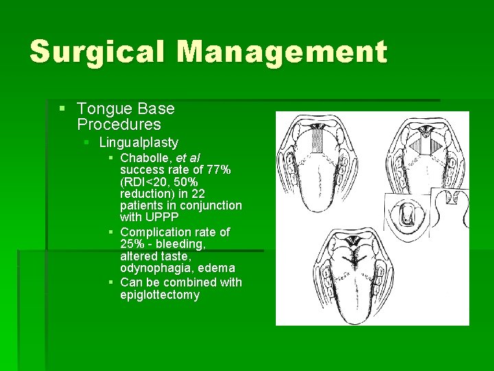 Surgical Management § Tongue Base Procedures § Lingualplasty § Chabolle, et al success rate