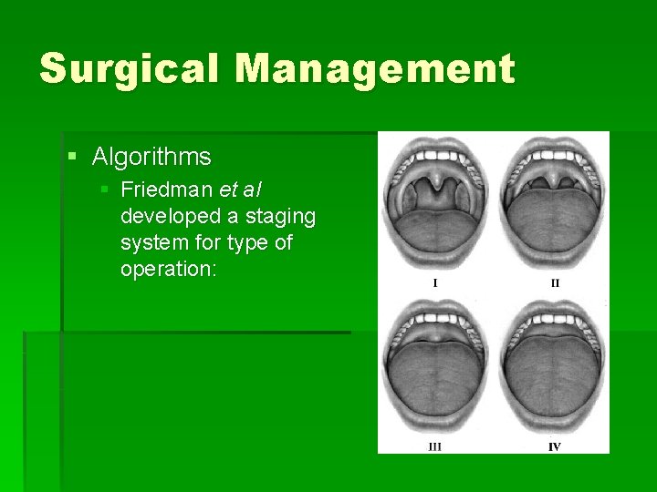 Surgical Management § Algorithms § Friedman et al developed a staging system for type