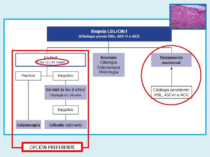 OPCIÓN PREFERENTE 