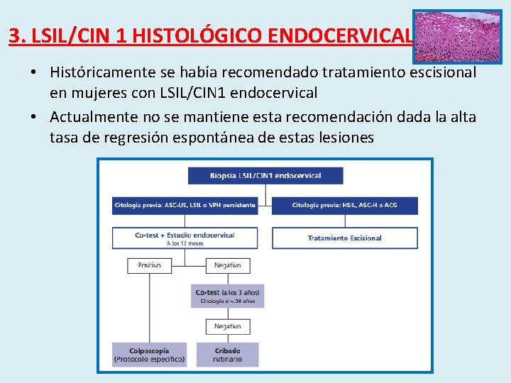 3. LSIL/CIN 1 HISTOLÓGICO ENDOCERVICAL • Históricamente se había recomendado tratamiento escisional en mujeres
