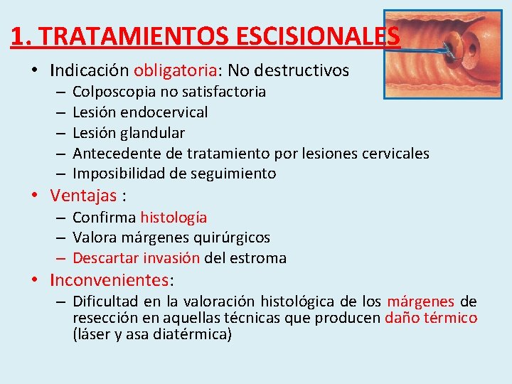 1. TRATAMIENTOS ESCISIONALES • Indicación obligatoria: No destructivos – – – Colposcopia no satisfactoria