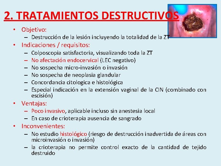 2. TRATAMIENTOS DESTRUCTIVOS • Objetivo: – Destrucción de la lesión incluyendo la totalidad de