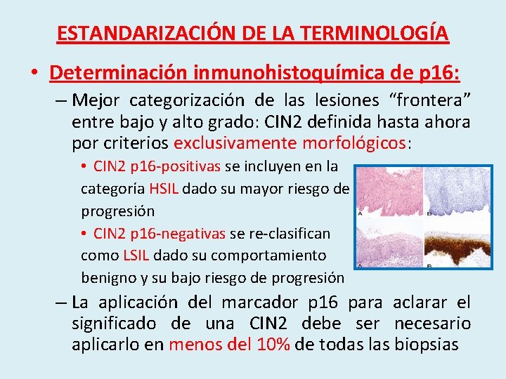 ESTANDARIZACIÓN DE LA TERMINOLOGÍA • Determinación inmunohistoquímica de p 16: – Mejor categorización de