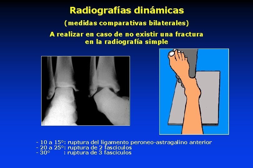 Radiografías dinámicas (medidas comparativas bilaterales) A realizar en caso de no existir una fractura Radiografías dinámicas (medidas comparativas bilaterales) A realizar en caso de no existir una fractura