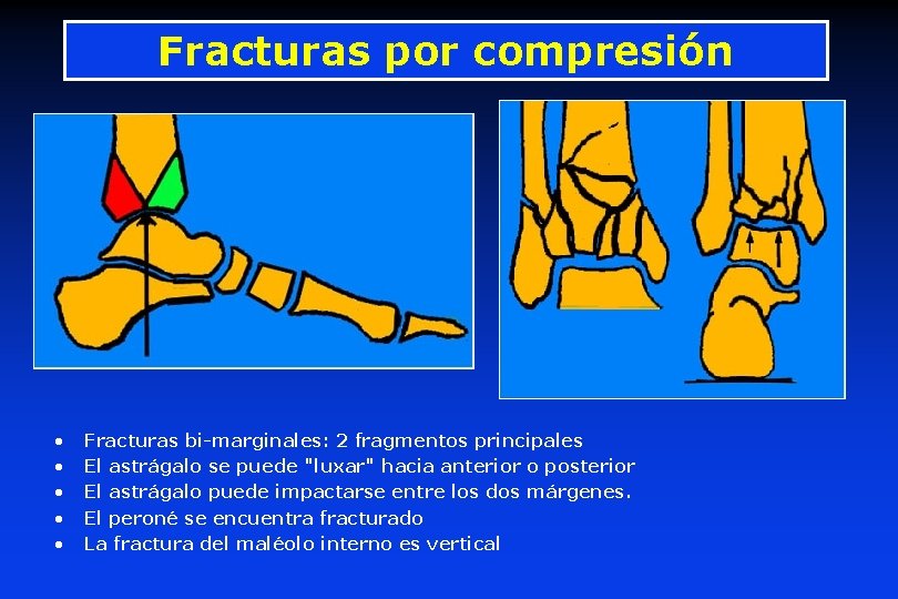 Fracturas por compresión • • • Fracturas bi-marginales: 2 fragmentos principales El astrágalo se