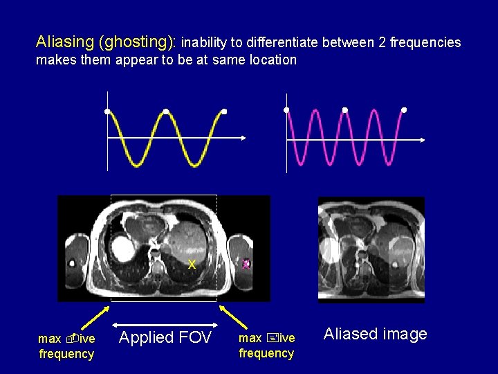 Aliasing (ghosting): inability to differentiate between 2 frequencies makes them appear to be at