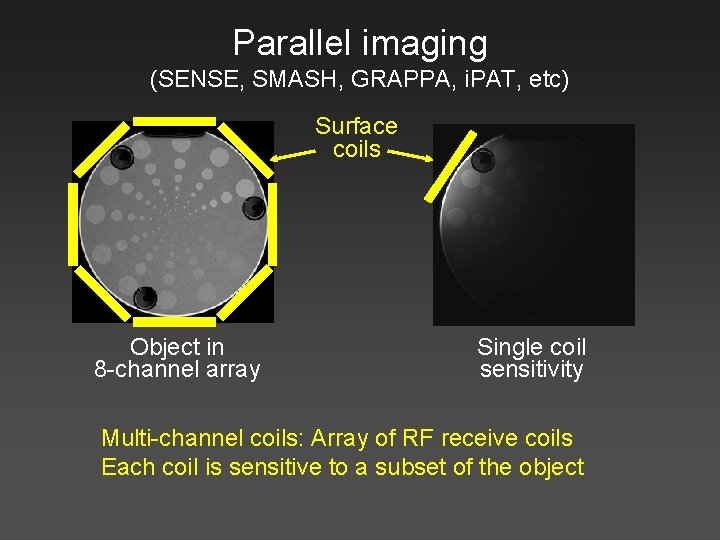 Parallel imaging (SENSE, SMASH, GRAPPA, i. PAT, etc) Surface coils Object in 8 -channel