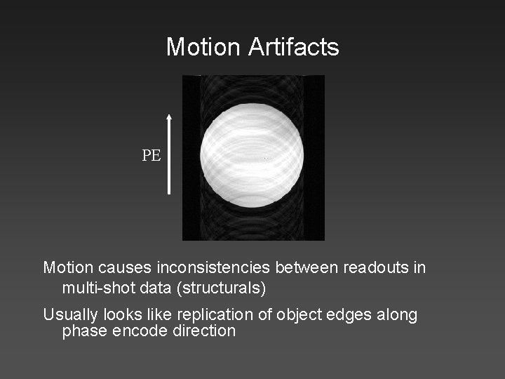 Motion Artifacts PE Motion causes inconsistencies between readouts in multi-shot data (structurals) Usually looks