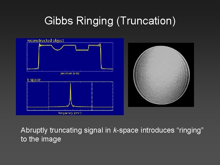 Gibbs Ringing (Truncation) Abruptly truncating signal in k-space introduces “ringing” to the image 