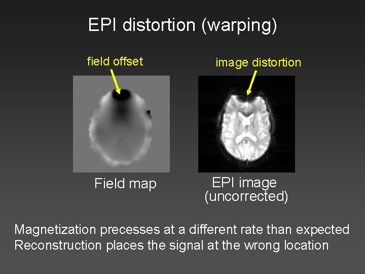 EPI distortion (warping) field offset Field map image distortion EPI image (uncorrected) Magnetization precesses