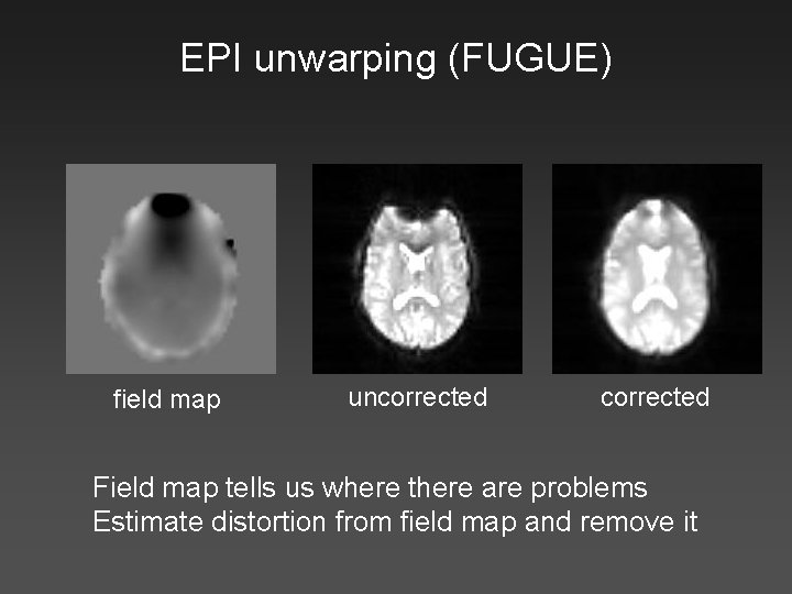 EPI unwarping (FUGUE) field map uncorrected Field map tells us where there are problems