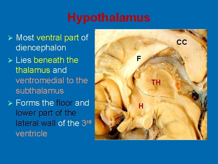 Hypothalamus Most ventral part of diencephalon Ø Lies beneath the thalamus and ventromedial to