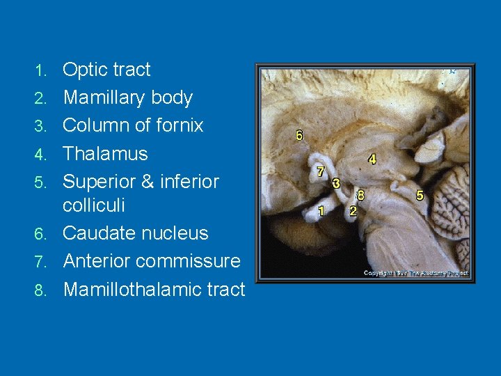 1. 2. 3. 4. 5. 6. 7. 8. Optic tract Mamillary body Column of
