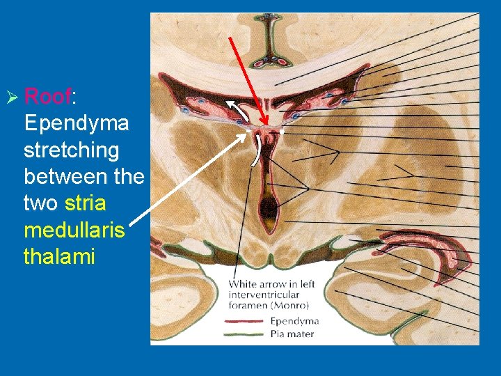 Ø Roof: Ependyma stretching between the two stria medullaris thalami 