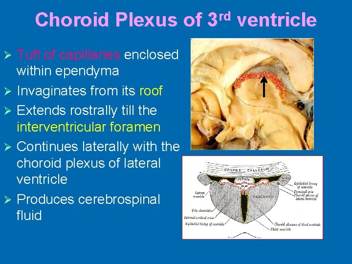Choroid Plexus of 3 rd ventricle Tuft of capillaries enclosed within ependyma Ø Invaginates