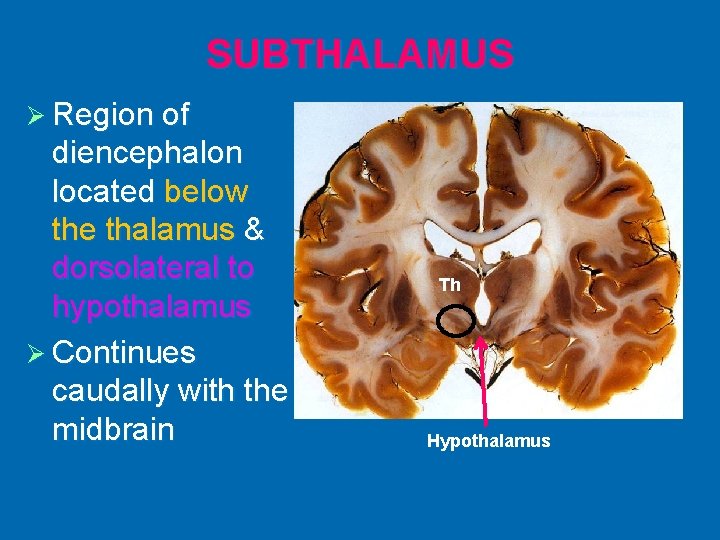 SUBTHALAMUS Ø Region of diencephalon located below the thalamus & dorsolateral to hypothalamus Ø