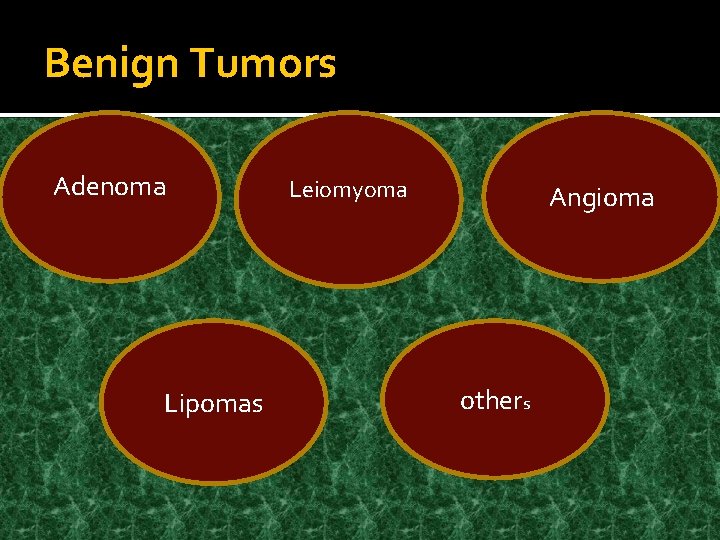 Benign Tumors Adenoma Lipomas Leiomyoma Angioma others 