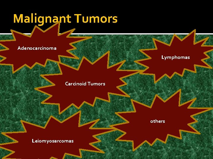 Malignant Tumors Adenocarcinoma Lymphomas Carcinoid Tumors others Leiomyosarcomas 